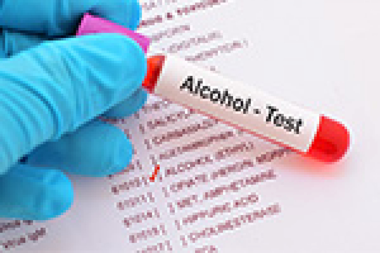AdobeStock_175959504_Blutentnahmen_fuer_Alkoholtests_kl